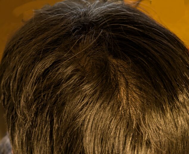 リグロ使用約4ヶ月経過