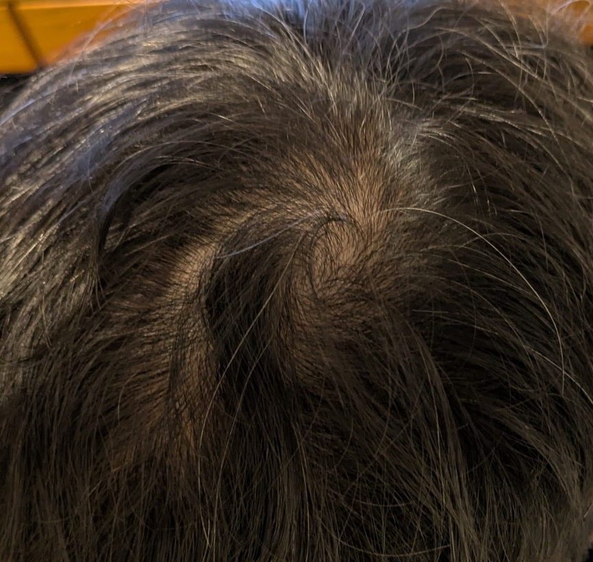 リグロ使用開始から約1.5ヶ月経過